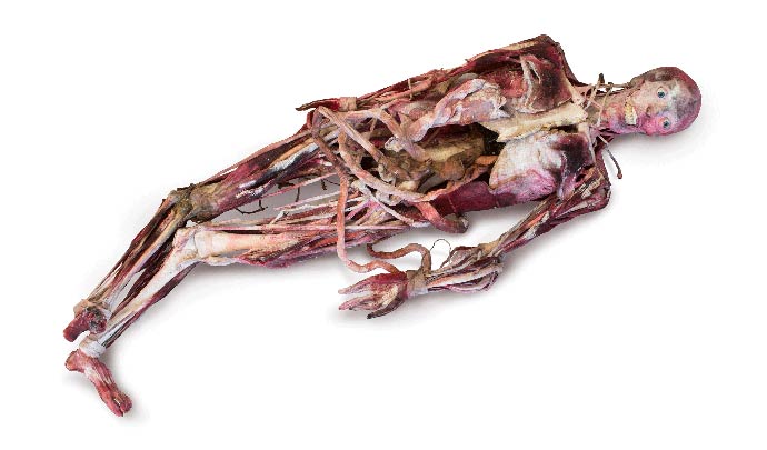 Desiccated Syndaver Body